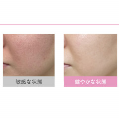 Увлажняющий гель для чувствительной кожи Dr. Ci:Labo Aqua Collagen Gel Sensitive EX