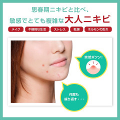 Пенка для умывания для кожи, склонной к акне Acne Barrier Protect Wash, 100 г